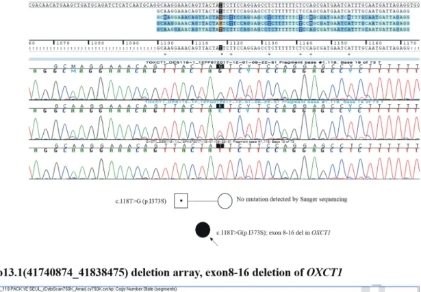 Fig. 1. Partial Sanger sequencing of OXCT1 showing a c.1118T>G (p.Ile373Ser) mutation in the patient and her father (A), and microarray results for this  patient presenting a partial deletion at 5p13.1(41740874_41838475) consistent with the region from 