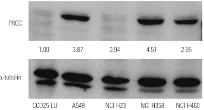 Fig. 3. siPRCC-mediated silencing of PRCC expression in lung cancer cell lines. After siPRCC transfection (siPRCC-1, siPRCC-2, and siPRCC-3) into NCI- NCI-H358 and A549 cells, PRCC expression was measured by real-time quantitative reverse transcriptase pol