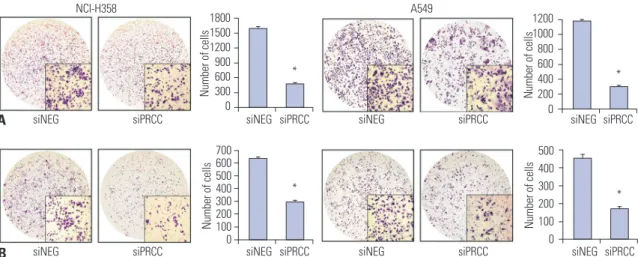Fig. 5. Effects of PRCC knockdown on migration and invasion. (A) Motility potential of siPRCC- and siNEG-transfected cells was examined using transwell  chambers