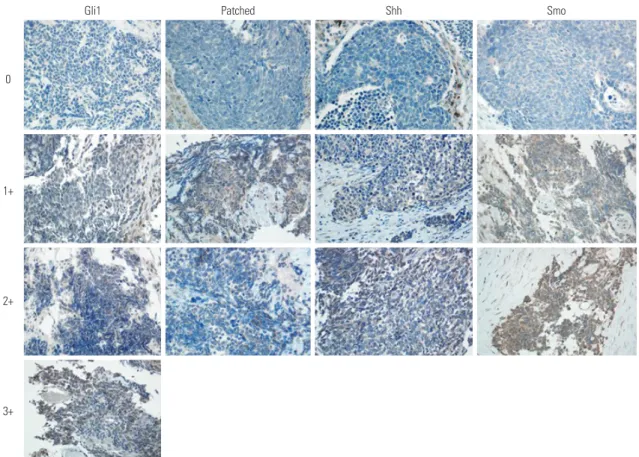 Fig. 1. Representative immune-histochemical staining intensity for Gli1, patched, sonic hedgehog (Shh), and Ptch-mediated repression of smoothened  (Smo) in patients with extensive stage small cell lung cancer