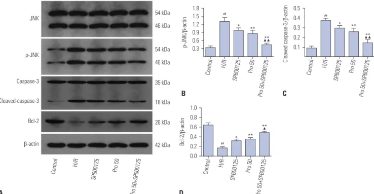 Fig. 5. Effects of propofol and SP600125 on the protein expression levels of JNK, p-JNK, caspase-3, cleaved-caspase-3, and Bcl-2 in HK-2 cells
