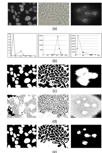 Fig. 4 The results of cell segmentation: (a) three original  images (b) Their approximated histograms (c)The results  of Otsu algorithm (d) The results of MAT algorithm (e) The  results of our algorithm