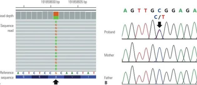 Fig. 2. Pathogenic STAT1 variant identified in the 24-year-old female patient. (A) Integrative Genomics Viewer snapshot of the STAT1 pathogenic variant  (NM_007315.3:c.800C>T, p.Ala267Val) (arrow) identified by whole-exome sequencing