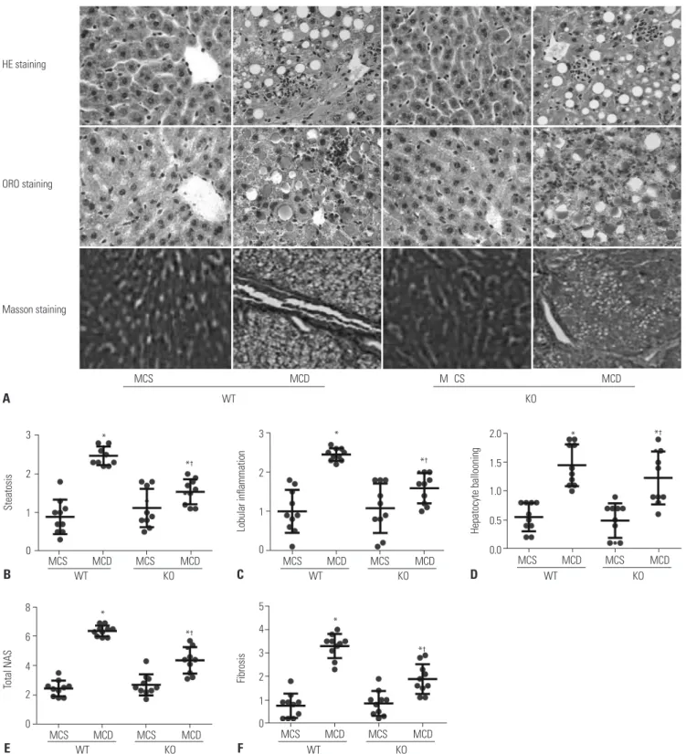 Fig. 4. S100A4 KO reduces liver tissue damage and inflammatory cell infiltration in MCD diet-induced NAFLD mice