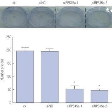 Fig. 2. Ribosomal protein S15a (RPS15a) expression in siRNA-transfected  gastric cancer and control cells as detected by quantitative PCR