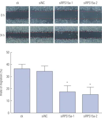 Fig. 6. Cell cycle analysis. The cell cycle distribution after ribosomal protein  S15a (RPS15a) interference for 48 h was determined (*p<0.05)