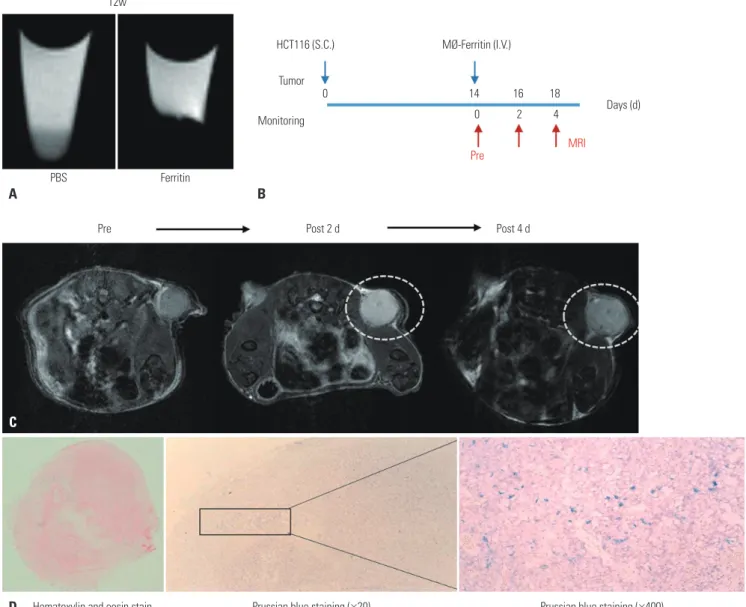 Fig. 5. Tracking of macrophages labeled with ferritin in a colon cancer mouse model using MRI