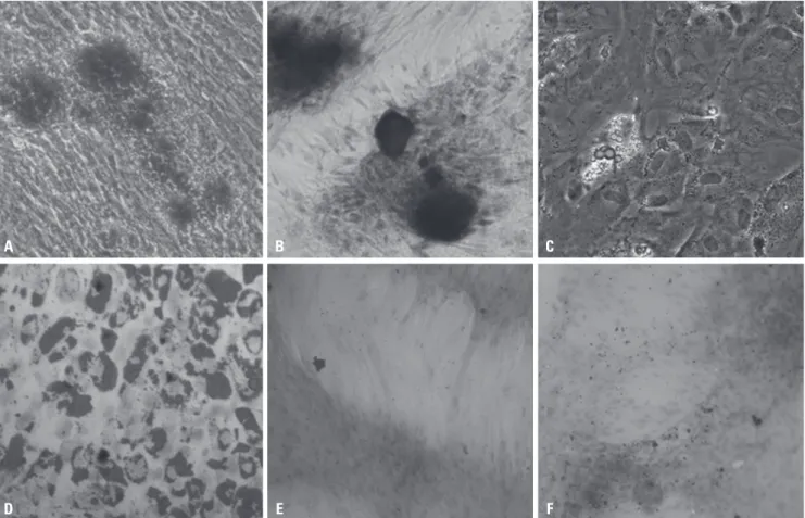Fig. 2. Differentiation and identification of UCMSCs. (A) The formation of mineralized matrix shown by alizarin red staining (×200)