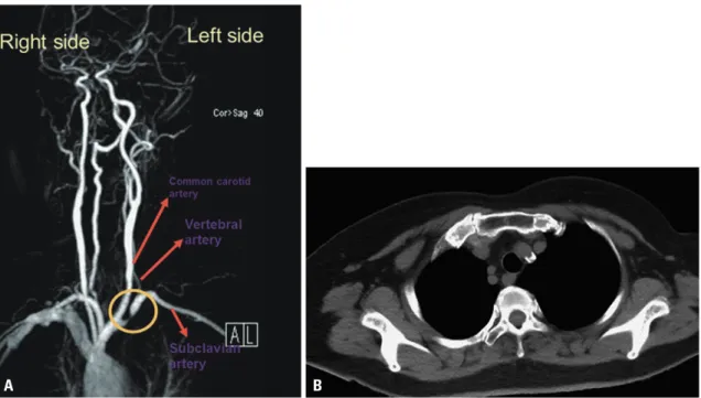 Fig. 1. Magnetic resonance angiogram (MRA) and computer tomography (CT) of the upper limb vessels