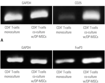 Fig. 3. Semi-quantitative PCR of CD25 (A) and FoxP3 (B). DP-MSC, den- den-tal pulp-derived mesenchymal stem cell.