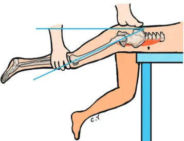 Fig. 2. The Silfverskiöld test. (A) The participant is placed in the supine position with the knee extended