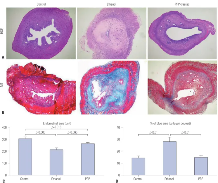 Fig. 2. Comparison of the endometrial morphology, area, and extent of fibrosis. (A) On H&amp;E staining, distinctive morphological changes in the endome- endome-trial characteristics were found in the glands, epithelial lining, and stroma between the ethan