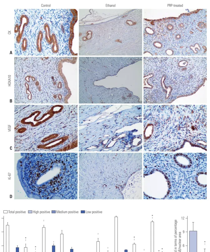 Fig. 3. Expression of (A) CK, (B) HOXA10, (C) VEGF, and (D) Ki-67 with IHC staining (left, control group; middle, ethanol group; right, PRP-treated group)