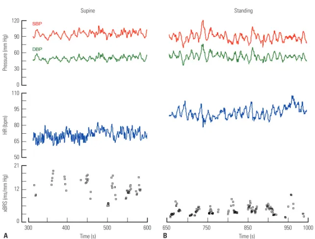 Fig. 2. BRS and hemodynamic parameters during head-up tilt test. Recordings during 5 min in the supine position immediately before upright posture (A)  and during 5 min in a standing position immediately after an upright posture (B) are shown