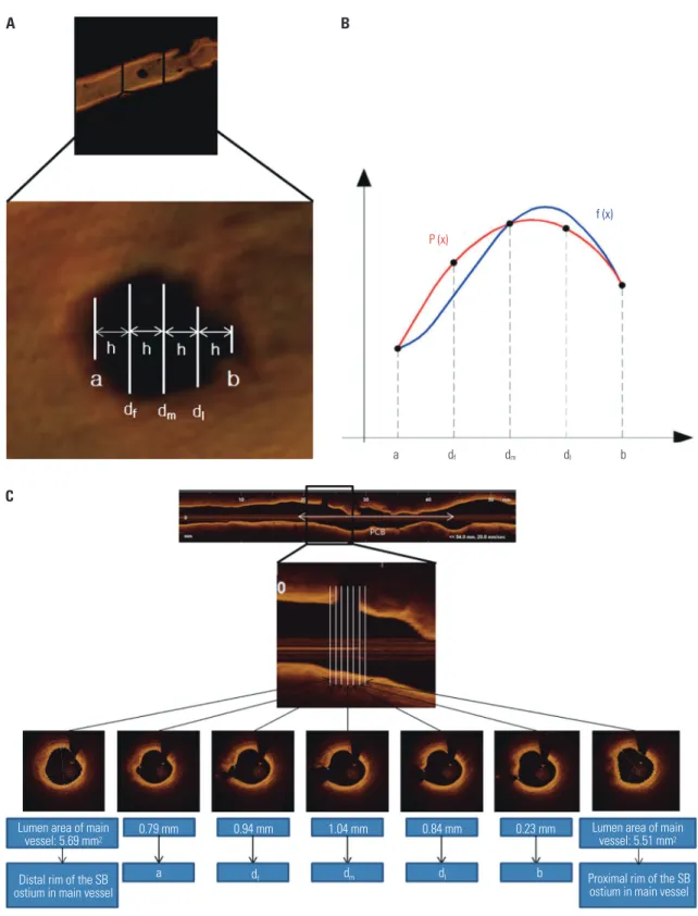 Fig. 2. Method of analysis of the SB ostium. Simpson’s rule is an approximation method for calculating the area of an irregular shape