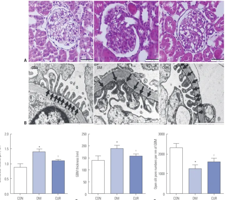 Fig. 3. Effect of curcumin on kidney histological morphology changes. (A) Representative image of glomerular hematoxylin and eosin (H&amp;E)-stained sec- sec-tions