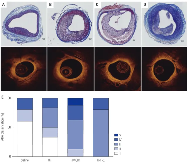Fig. 6. OCT images of matched rabbit iliac artery histologic sections and histologic classification based on AHA criteria