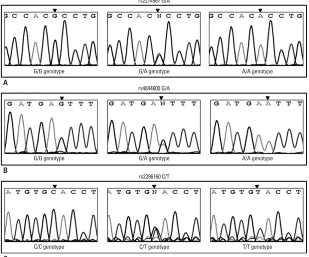 Fig. 1. PCR-direct sequencing. CR1 gene rs2274567 site genotype GG, GA, and AA (A). CR1 gene rs4844600 site genotype GG, GA, and AA  (B)