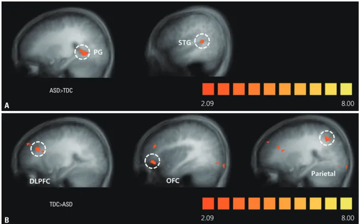 Fig. 2. Different brain activation maps of ASDs and TDCs with a social reward learning effect