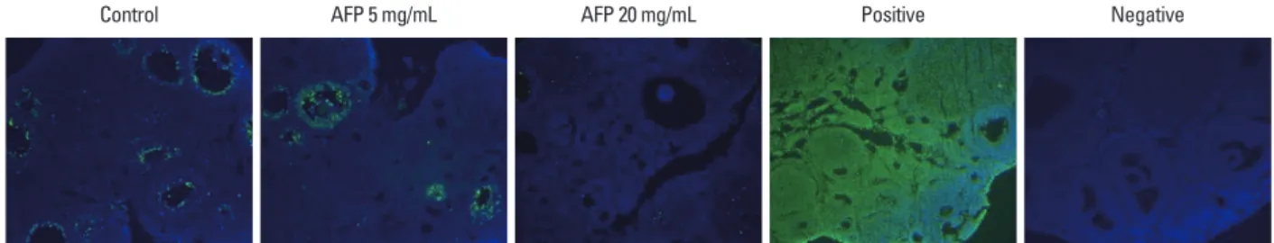 Fig. 3. Fluorescent TUNEL staining for vitrified-warmed ovaries of control group, antifreeze protein (AFP) 5 mg/mL treated group, AFP 20 mg/mL treated  group, positive and negative control (×100, DAPI-counterstained)