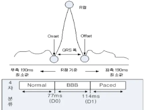 그림 5. QRS폭에 따른 Normal, BBB, Paced Beat 판단기준 Fig. 5 Normal, BBB, Paced Beat classification rule using  QRS width 2.2