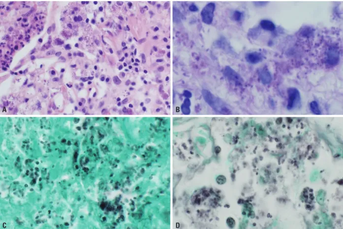 Fig. 3. Histopathologic examination of the lung. (A) Hematoxylin and eosin stain (×400)