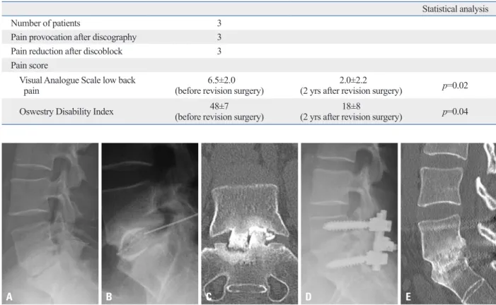Table 4. Results of Discoblock and Revision Surgery in Low Back Pain (+) of Non-Union Group
