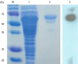 Fig. 1. Analysis of expression of the MPT64 protein in TB-1 cells. TB-1 cells  were inducted with 1 mM IPTG for 4 h, and the cell lysates were analysed  by SDS-PAGE, after which the gel was stained with Coomassie blue (lanes  1 to 2) or analysed by Western
