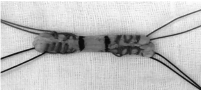 Fig. 2. Additional fixation devices used for this study. (A) 9×25 mm BioScrew ® . (B) 6×16.5 mm Duet TM 