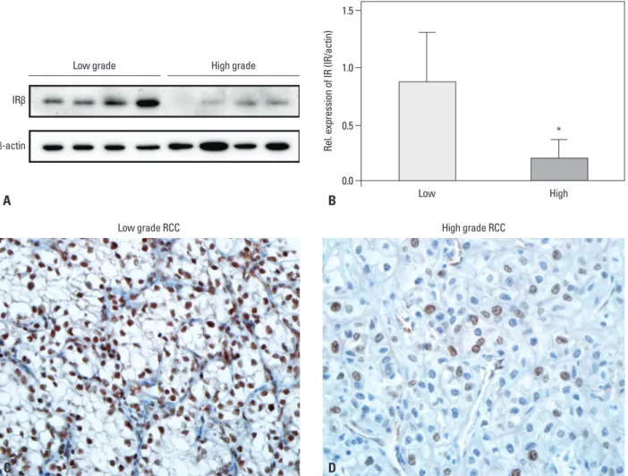 Fig. 2. Expression level of insulin receptor (IR) in clear cell renal cell carcinoma (CCRCC) is associated with tumor grade