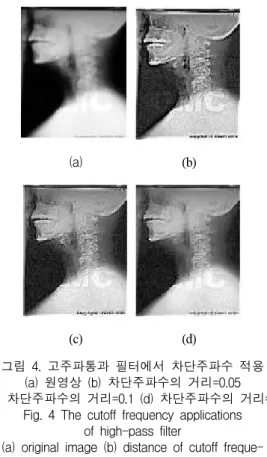 Fig.  4  The  cutoff  frequency  applications  of  high-pass  filter