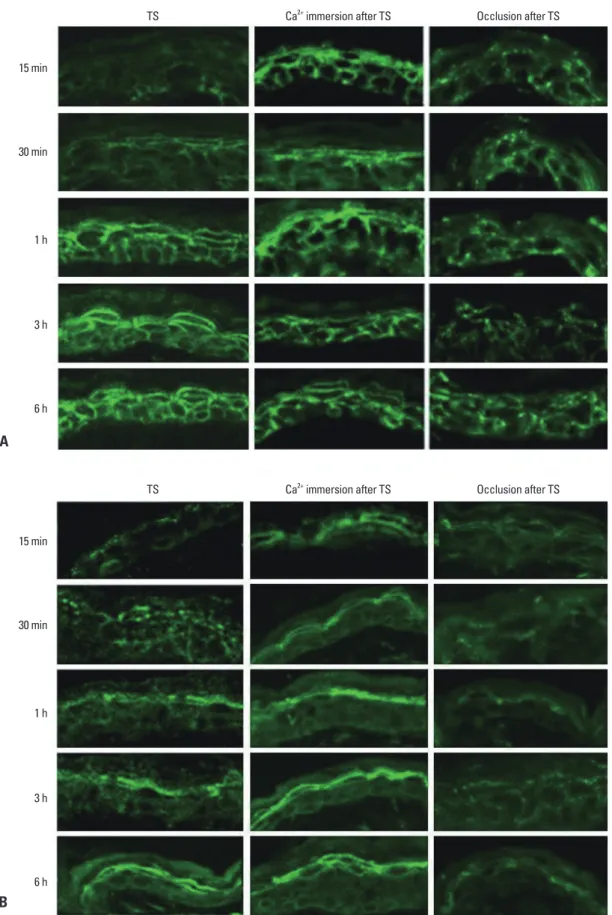 Fig. 3. Effect of epidermal Ca 2+  gradient modulation on the expression and localization of Cldn-1 and Cldn-4 in murine epidermis