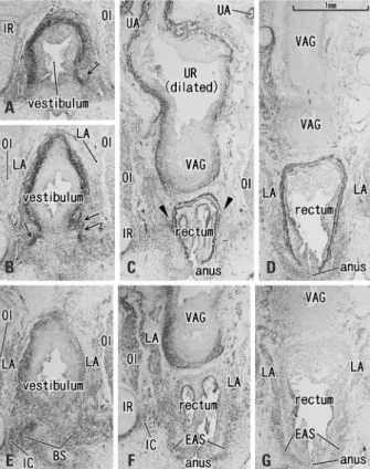 Fig. 1. Developing vaginal vestibulum accompanies smooth muscle coat at  13 weeks. Frontal sections