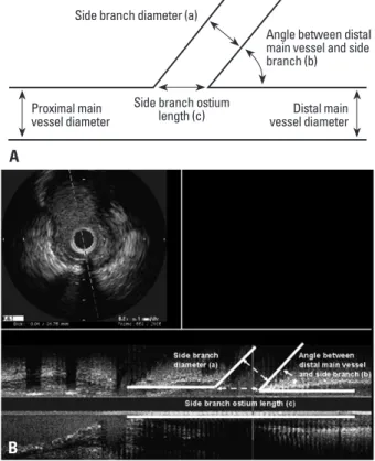 Fig. 1. Intravascular ultrasound (IVUS) measurements in this study are  shown in a schematic diagram (A) and an actual IVUS image (B); side  branch diameter (a), angle between distal main vessel and side branch (b),  and side branch ostium length (c)