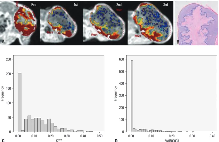 Fig. 4. A representative case of good response in mouse #2. (A) Serial DCE-MRI with color mapping shows higher pretreatment K trans  (0.29) and marked reduc- reduc-tion in K trans  after the first radiation therapy (K 1 R=0.47)