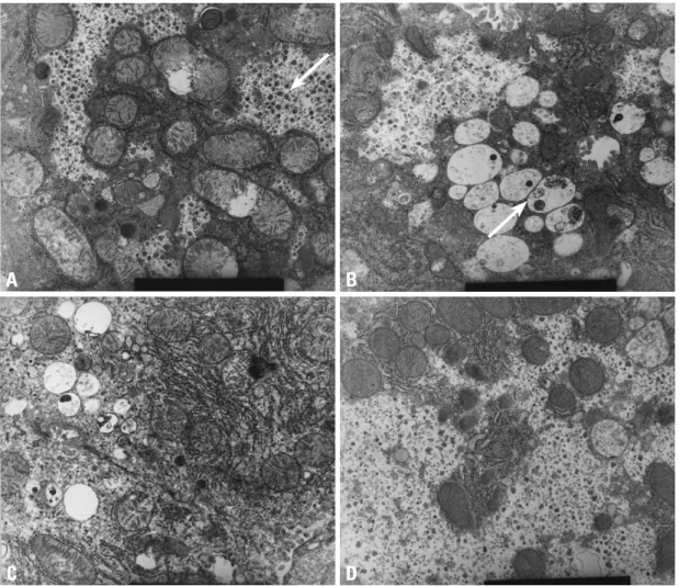 Fig. 1. High power electron microscopic findings (9.0 × 9,000). (A) Wild type: the arrow shows large amounts of glycogen particles in the  cytoplasm