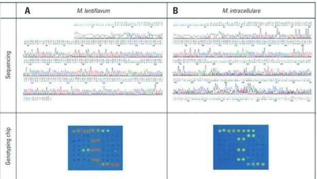 Fig. 1. In-house MTB PCR. Lane 1, size marker; Lane 2, internal control; 