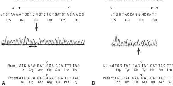 Fig. 1. Nucleotide sequences of the mutated sections of exons 1 and 5 and the promoter region of the gene encoding UDP-glucurono- UDP-glucurono-syltransferase 1A1 (UGT1A1)