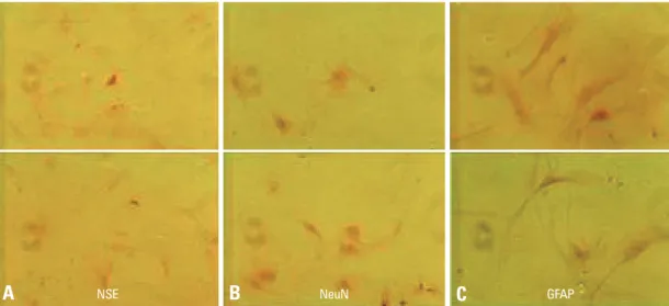 Fig. 8. Immunofluorescence staining (×200). (A and B) GFAP, glial fibrillary acidic protein