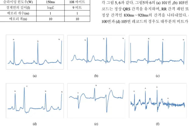 Fig.  5  Pattern  for  QRS  region.  (a)  No.  100  record  (b)  No.  103  record  (c)  No