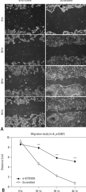 Fig. 3. Cell migration assay: the artificial wound gap became significantly  narrower in the control group as time passed by 20, 28, 44 hours, compared  to the si-KITENIN group (p<0.001)(B)