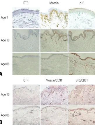 Fig. 6. Immunohistochemical staining of moesin and p16. (A) Immunohistoche- Immunohistoche-mical staining of moesin and p16 was performed on the neonatal prepuce (Age 1) and the skin of the 10-year-old child (Age 10) and the 86-year-old adult (Age 86)