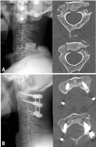 Fig. 1. Older patients required proportionately longer time to fuse. 