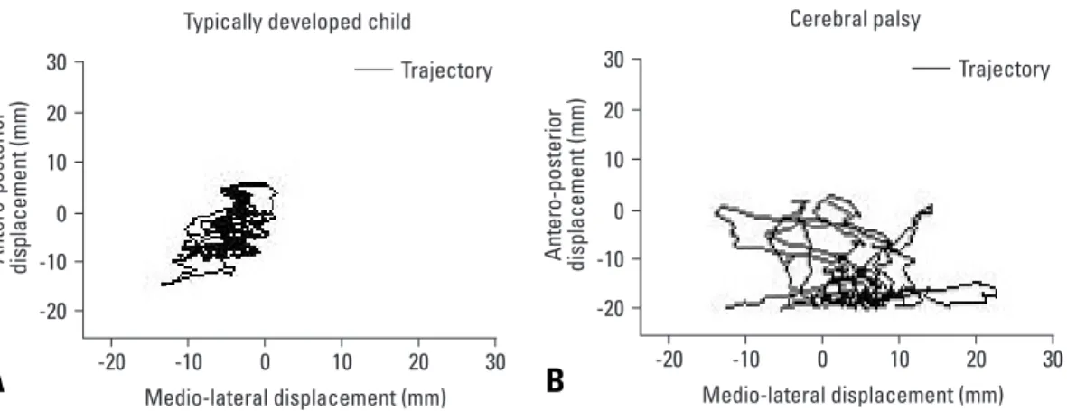Fig. 2. Examples of trajectories in typically developing (TD) child and cerebral palsy (CP) child without an ankle-foot orthosis