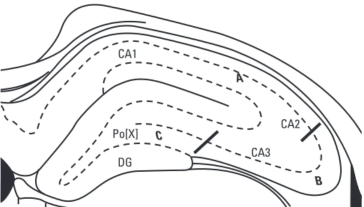 Fig. 1. Division of the hippocampus into 3 sectors for damage analysis. (A) CA1+CA2, (B) CA3, (C) CA3 + dentate gyrus (DG).