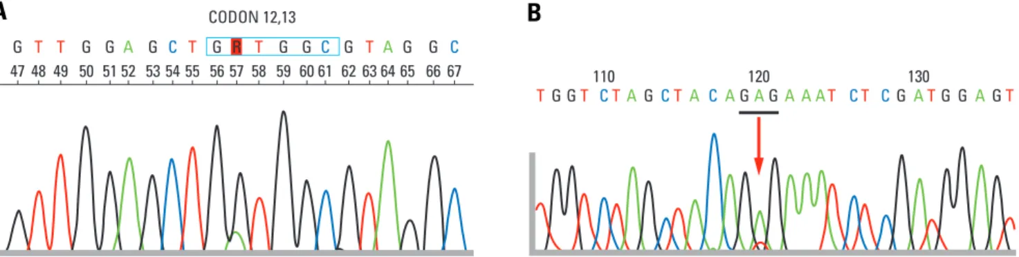 Fig. 3. Chromatograms of TP53 nucleotide sequences. Nucleotide sequences determined by chromatograms are shown for different types of TP53 mutations.