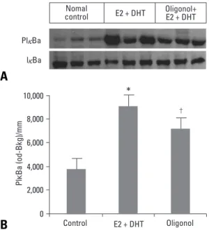 Fig. 7. Effect of E2 + DHT and oligonol on I K Ba phosphorylation. A: pIκ Ba and Iκ Ba expression using Western blotting analysis