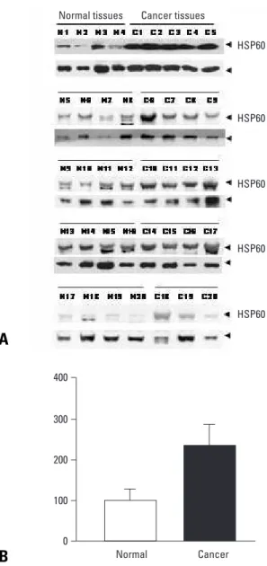 Fig. 3. (A) RT-PCR analysis of HSP60 mRNA in normal (lane 1-8) and cervical cancer (lane 9-16) tissues