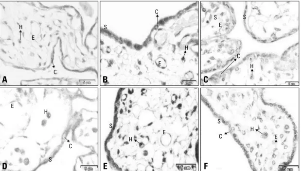 Fig. 4. Comparison of immunohistochemical H-scores for membranous VEGFR-2 in the cells of control and pre-eclamptic patients at  ≤ 34 and > 34 weeks