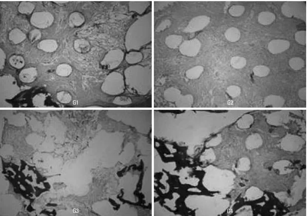 Fig. 6. Light micrographs of the specimens taken 4 weeks after grafting. Bone formation was not observed in grafts G1 and G2